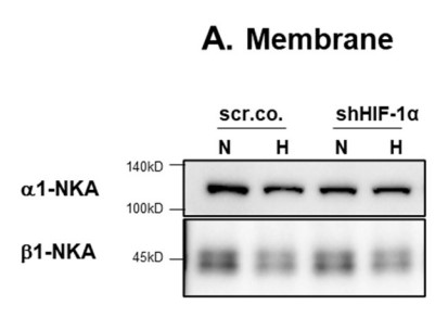 Fig1. Effect of hypoxia and HIF-1α silencing on the abundance of α1-NKA in plasma membranes.