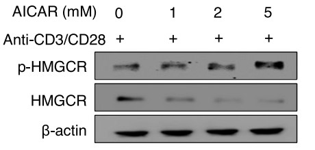 Fig1. Detection of the phosphorylated and dephosphorylated form of HMGCR from WT Tregs. (Ram Hari Pokhrel, 2021)